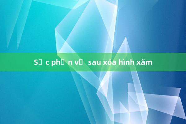 Sốc phản vệ sau xóa hình xăm